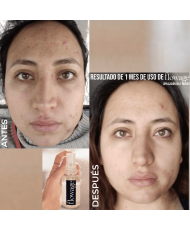 Suero Hidratante Flowage 